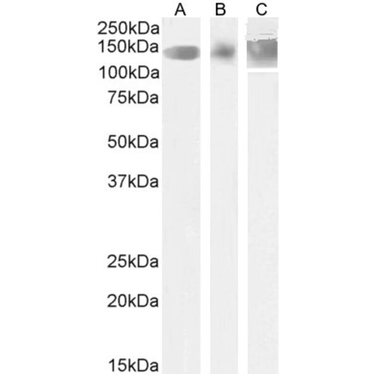 Western Blot - Anti-Leptin Receptor Antibody (A83422) - Antibodies.com