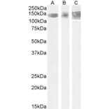 Western Blot - Anti-Leptin Receptor Antibody (A83422) - Antibodies.com