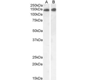 Western Blot - Anti-LEPR Antibody (A83422) - Antibodies.com