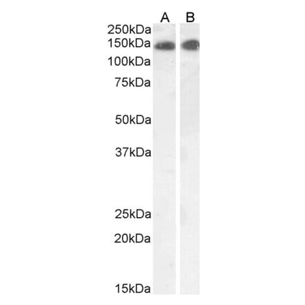 Western Blot - Anti-LEPR Antibody (A83422) - Antibodies.com
