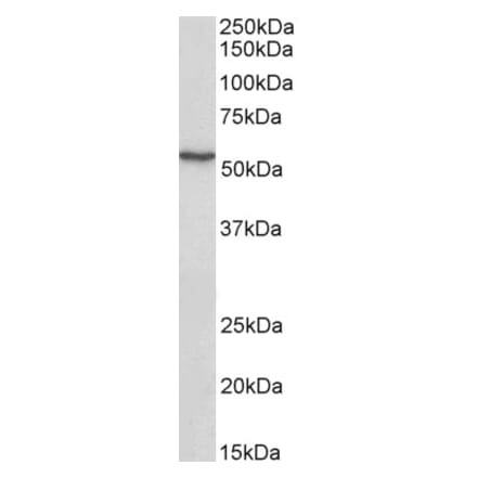 Western Blot - Anti-ATF7 Antibody (A83423) - Antibodies.com