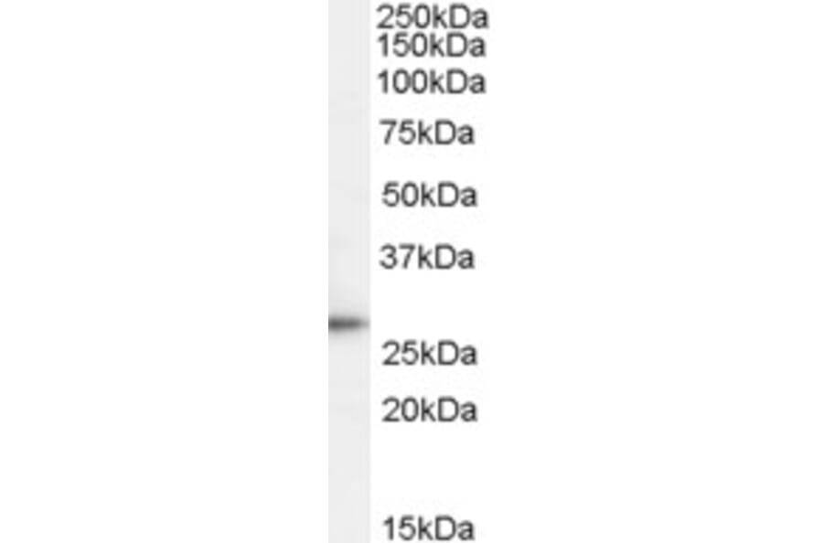 Western Blot - Anti-TPD52 Antibody (A83425) - Antibodies.com