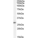Western Blot - Anti-TPD52 Antibody (A83425) - Antibodies.com