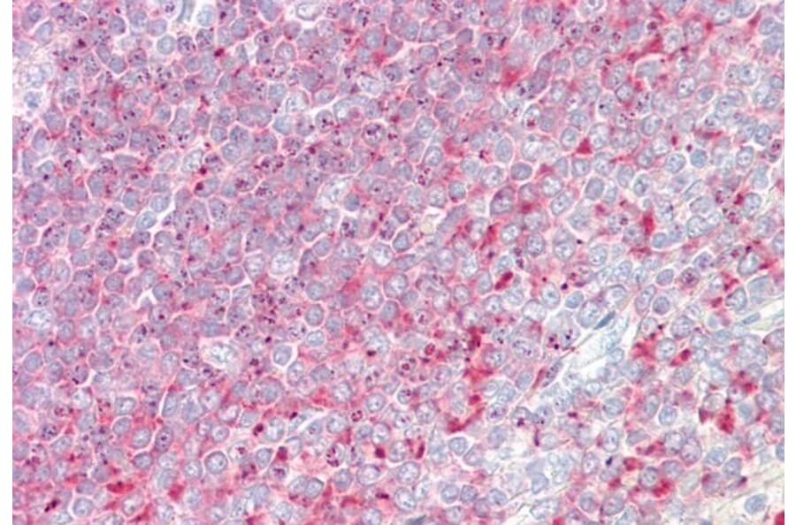 Immunohistochemistry - Anti-TPD52 Antibody (A83425) - Antibodies.com