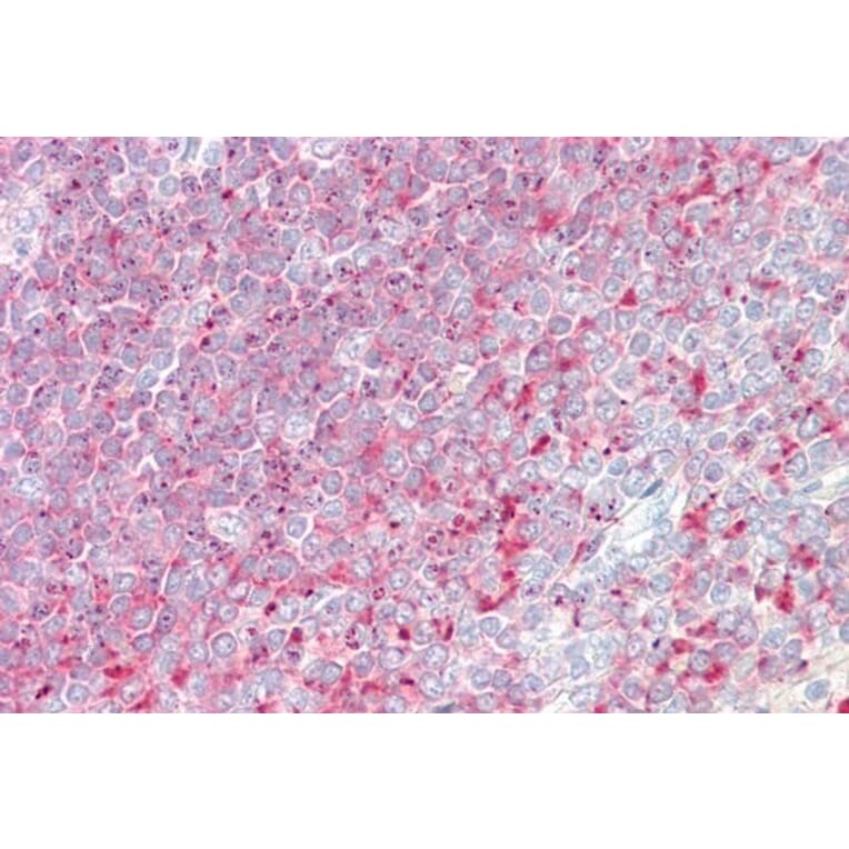 Immunohistochemistry - Anti-TPD52 Antibody (A83425) - Antibodies.com