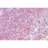 Immunohistochemistry - Anti-TPD52 Antibody (A83425) - Antibodies.com