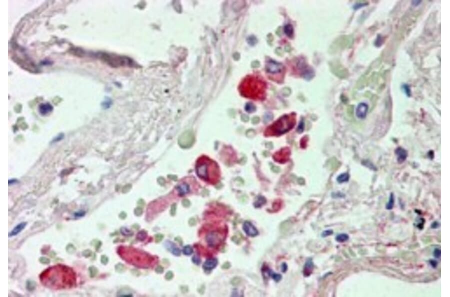 Immunohistochemistry - Anti-Liver Carboxylesterase 1/CES1 Antibody (A83426) - Antibodies.com