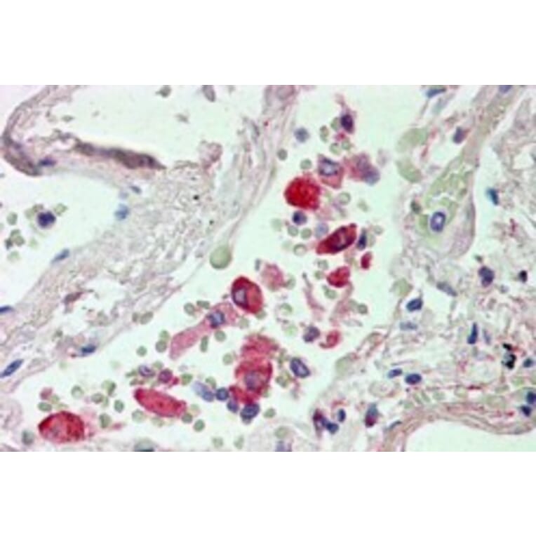 Immunohistochemistry - Anti-Liver Carboxylesterase 1/CES1 Antibody (A83426) - Antibodies.com