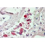 Immunohistochemistry - Anti-Liver Carboxylesterase 1/CES1 Antibody (A83426) - Antibodies.com