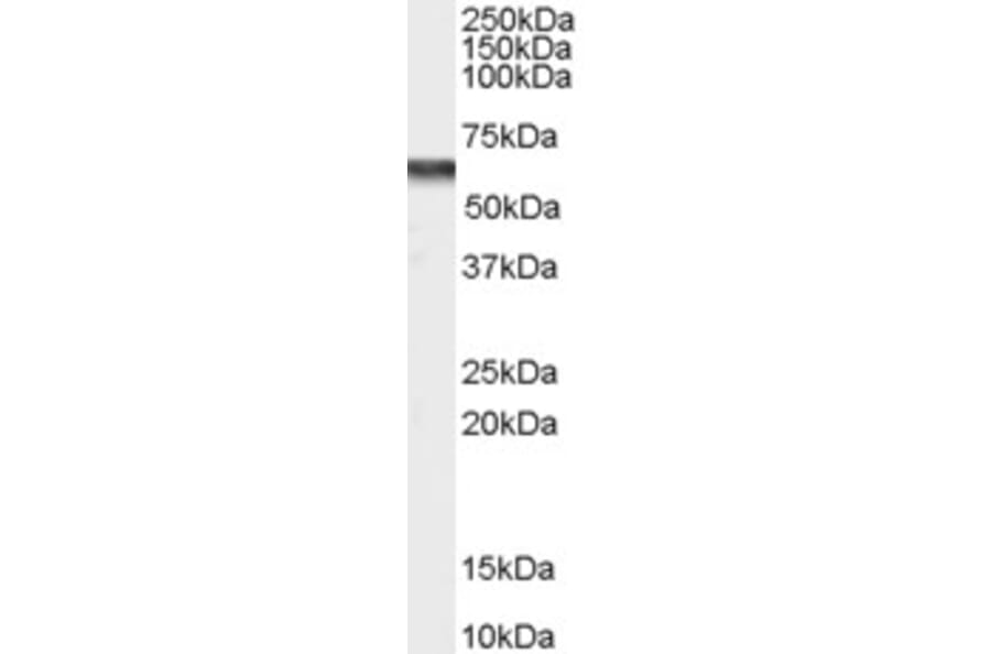 Western Blot - Anti-CACNB4 Antibody (A83427) - Antibodies.com