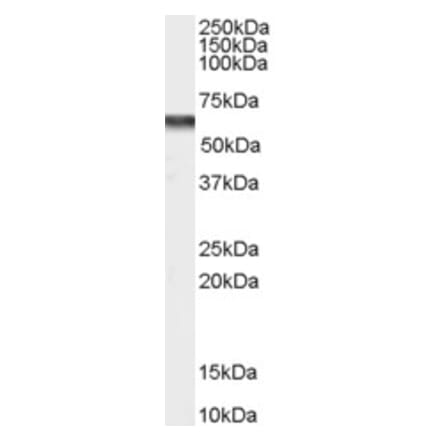 Western Blot - Anti-CACNB4 Antibody (A83427) - Antibodies.com