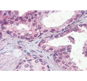 Immunohistochemistry - Anti-IFNAR2 Antibody (A83428) - Antibodies.com