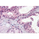 Immunohistochemistry - Anti-IFNAR2 Antibody (A83428) - Antibodies.com