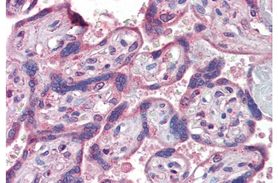 Immunohistochemistry - Anti-IFNAR2 Antibody (A83428) - Antibodies.com