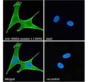 Immunofluorescence - Anti-NMDAR1 Antibody (A83429) - Antibodies.com