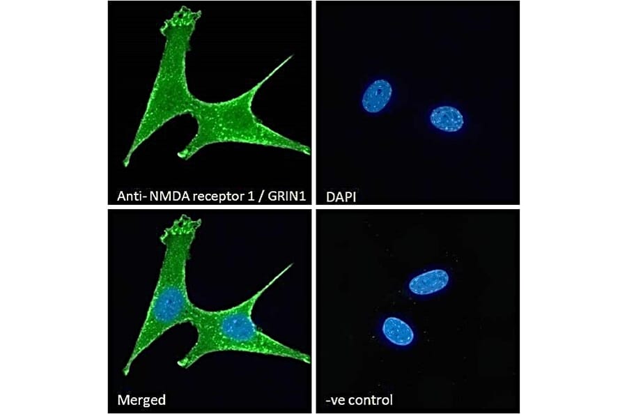 Immunofluorescence - Anti-NMDAR1 Antibody (A83429) - Antibodies.com