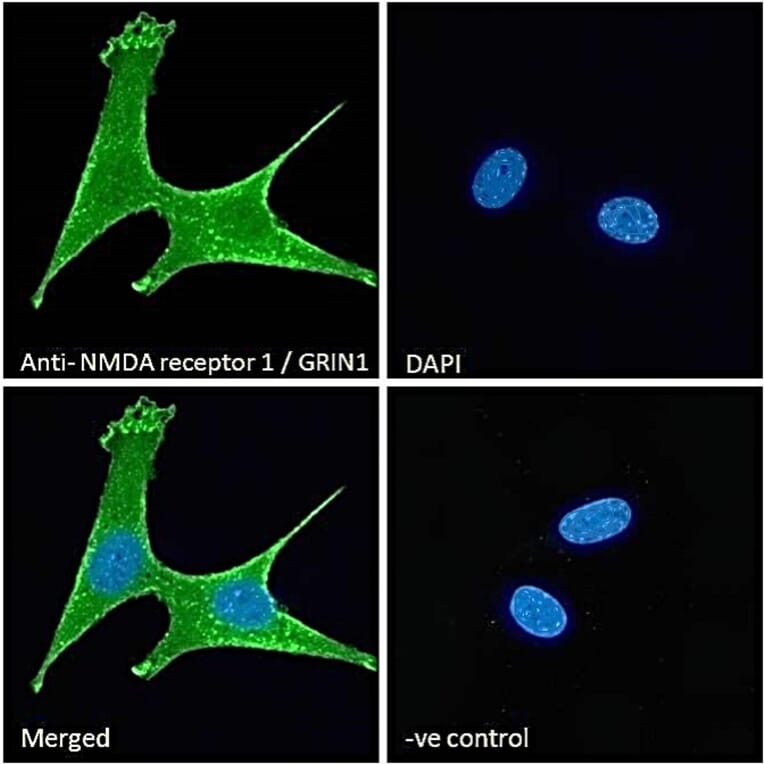Immunofluorescence - Anti-NMDAR1 Antibody (A83429) - Antibodies.com