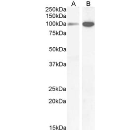 Western Blot - Anti-GRIN1 Antibody (A83429) - Antibodies.com