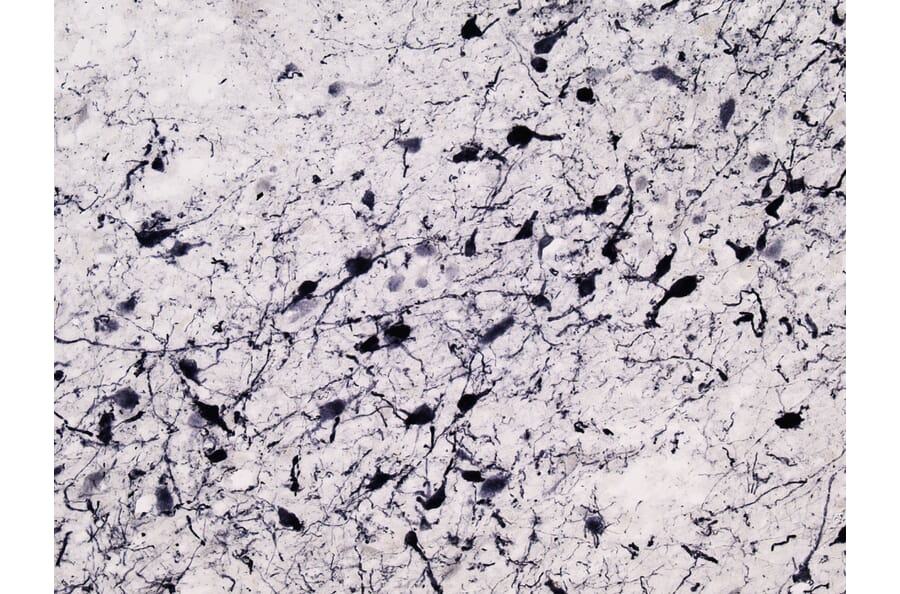 Immunohistochemistry - Anti-Tyrosine Hydroxylase Antibody (A83430) - Antibodies.com