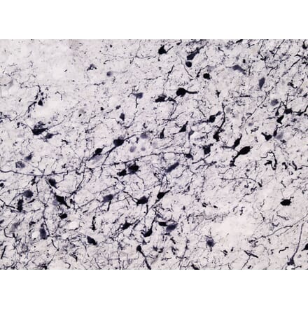 Immunohistochemistry - Anti-Tyrosine Hydroxylase Antibody (A83430) - Antibodies.com