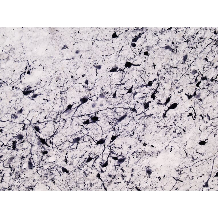 Immunohistochemistry - Anti-Tyrosine Hydroxylase Antibody (A83430) - Antibodies.com