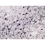 Immunohistochemistry - Anti-Tyrosine Hydroxylase Antibody (A83430) - Antibodies.com