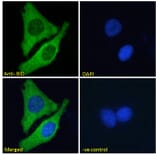 Immunofluorescence - Anti-Bid Antibody (A83431) - Antibodies.com