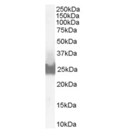 Western Blot - Anti-BID Antibody (A83431) - Antibodies.com