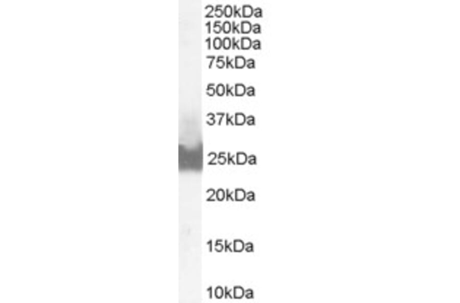 Western Blot - Anti-Bid Antibody (A83431) - Antibodies.com