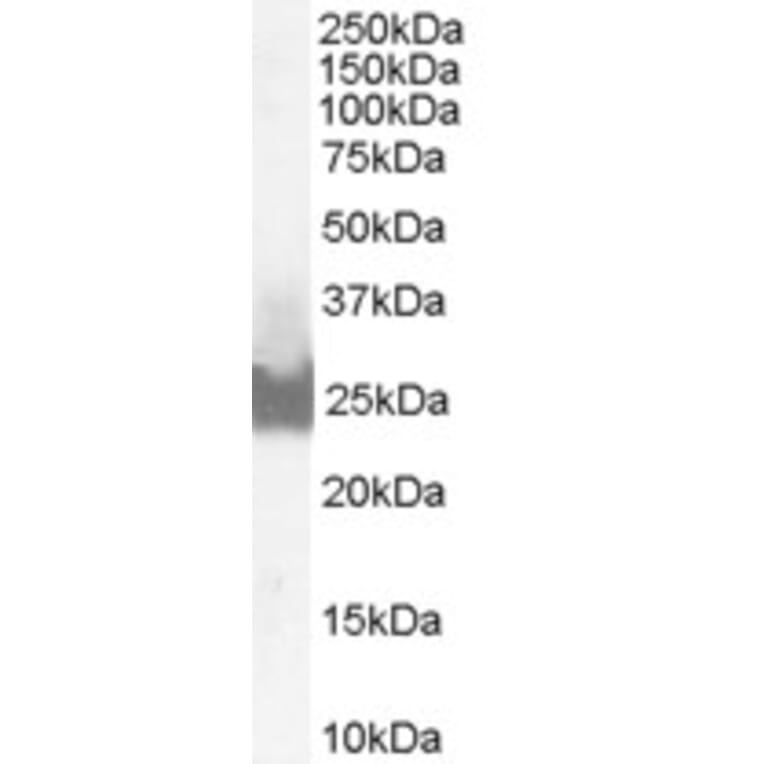 Western Blot - Anti-Bid Antibody (A83431) - Antibodies.com