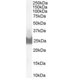 Western Blot - Anti-Bid Antibody (A83431) - Antibodies.com