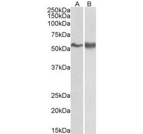 Western Blot - Anti-Fyn Antibody (A83433) - Antibodies.com