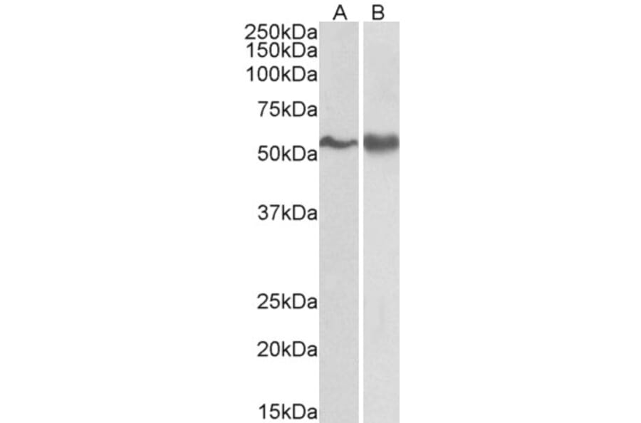 Western Blot - Anti-Fyn Antibody (A83433) - Antibodies.com