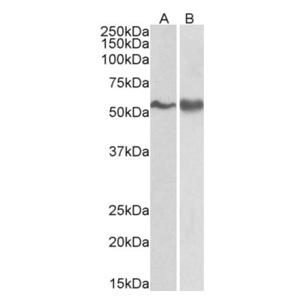 Western Blot - Anti-Fyn Antibody (A83433) - Antibodies.com