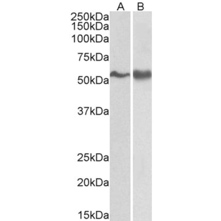 Western Blot - Anti-Fyn Antibody (A83433) - Antibodies.com