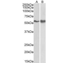 Western Blot - Anti-FYN Antibody (A83433) - Antibodies.com