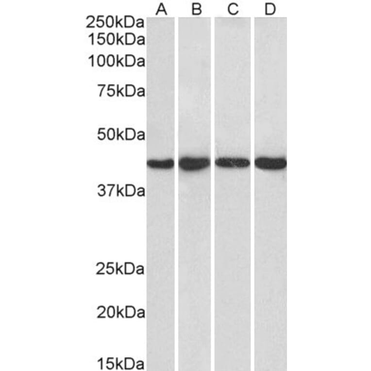 Western Blot - Anti-NIPP1 Antibody (A83435) - Antibodies.com
