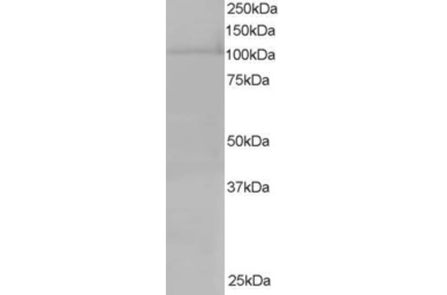 Western Blot - Anti-XPO7 Antibody (A83436) - Antibodies.com