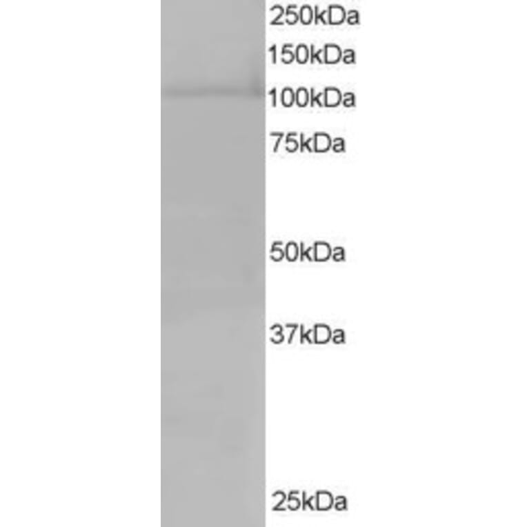 Western Blot - Anti-XPO7 Antibody (A83436) - Antibodies.com