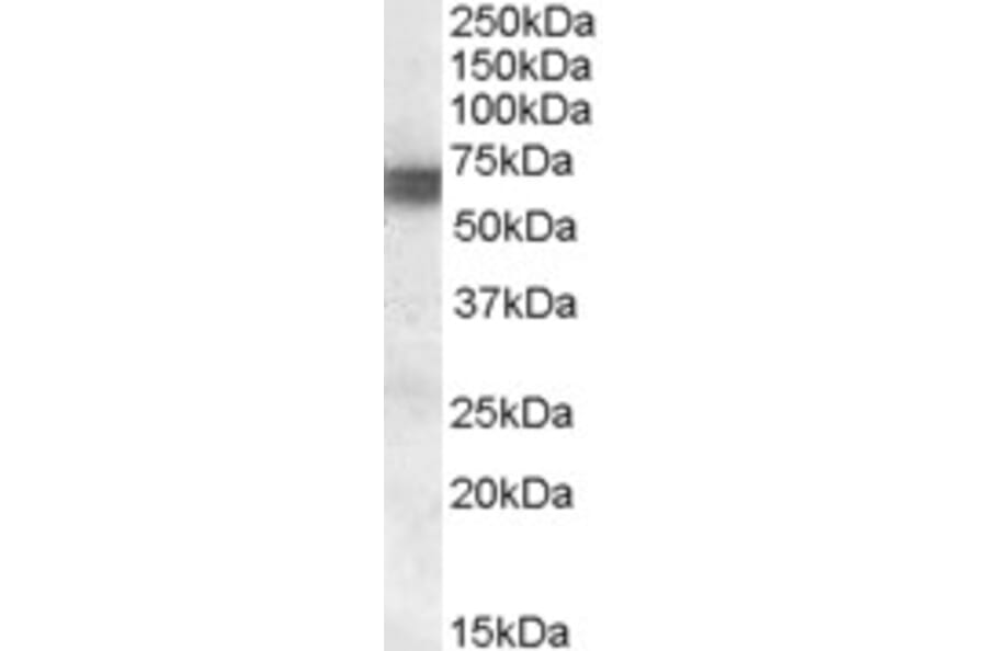 Western Blot - Anti-BIN1 Antibody (A83437) - Antibodies.com