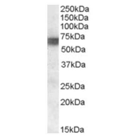 Western Blot - Anti-BIN1 Antibody (A83437) - Antibodies.com