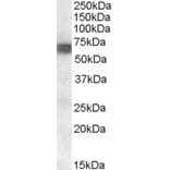 Western Blot - Anti-BIN1 Antibody (A83437) - Antibodies.com