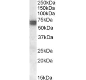 Western Blot - Anti-BIN1 Antibody (A83437) - Antibodies.com