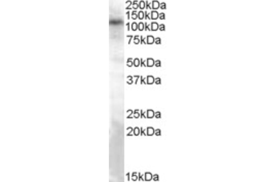 Western Blot - Anti-TRPC4 Antibody (A83438) - Antibodies.com