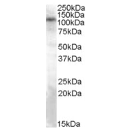 Western Blot - Anti-TRPC4 Antibody (A83438) - Antibodies.com