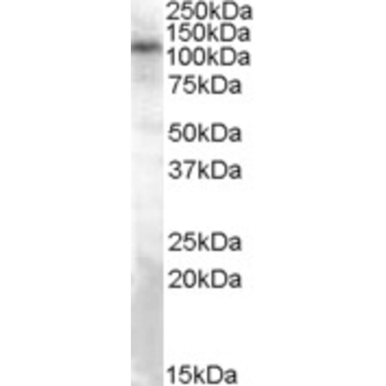 Western Blot - Anti-TRPC4 Antibody (A83438) - Antibodies.com