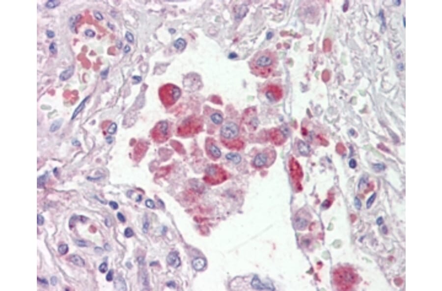 Immunohistochemistry - Anti-OSBPL9 Antibody (A83439) - Antibodies.com