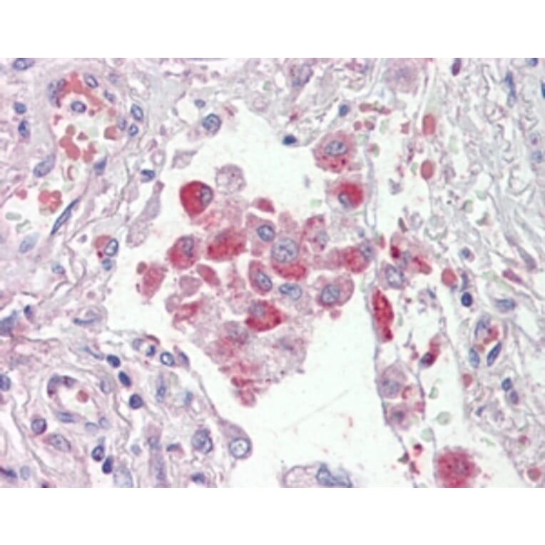 Immunohistochemistry - Anti-OSBPL9 Antibody (A83439) - Antibodies.com