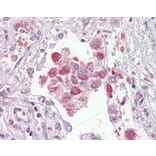 Immunohistochemistry - Anti-OSBPL9 Antibody (A83439) - Antibodies.com
