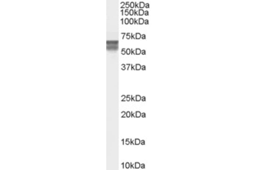 Western Blot - Anti-CACNB4 Antibody (A83440) - Antibodies.com